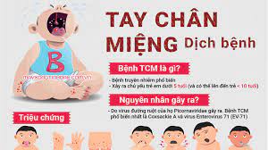 Bệnh tay chân miệng: Nguyên nhân, triệu chứng và các biện pháp phòng ngừa